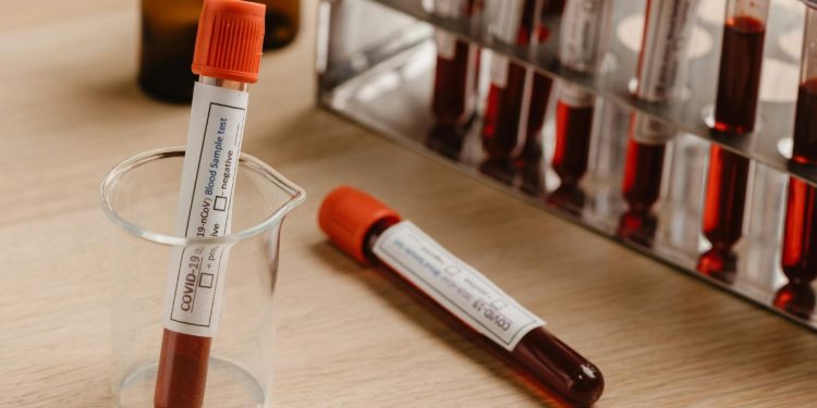 Sangue e sangue artificiale