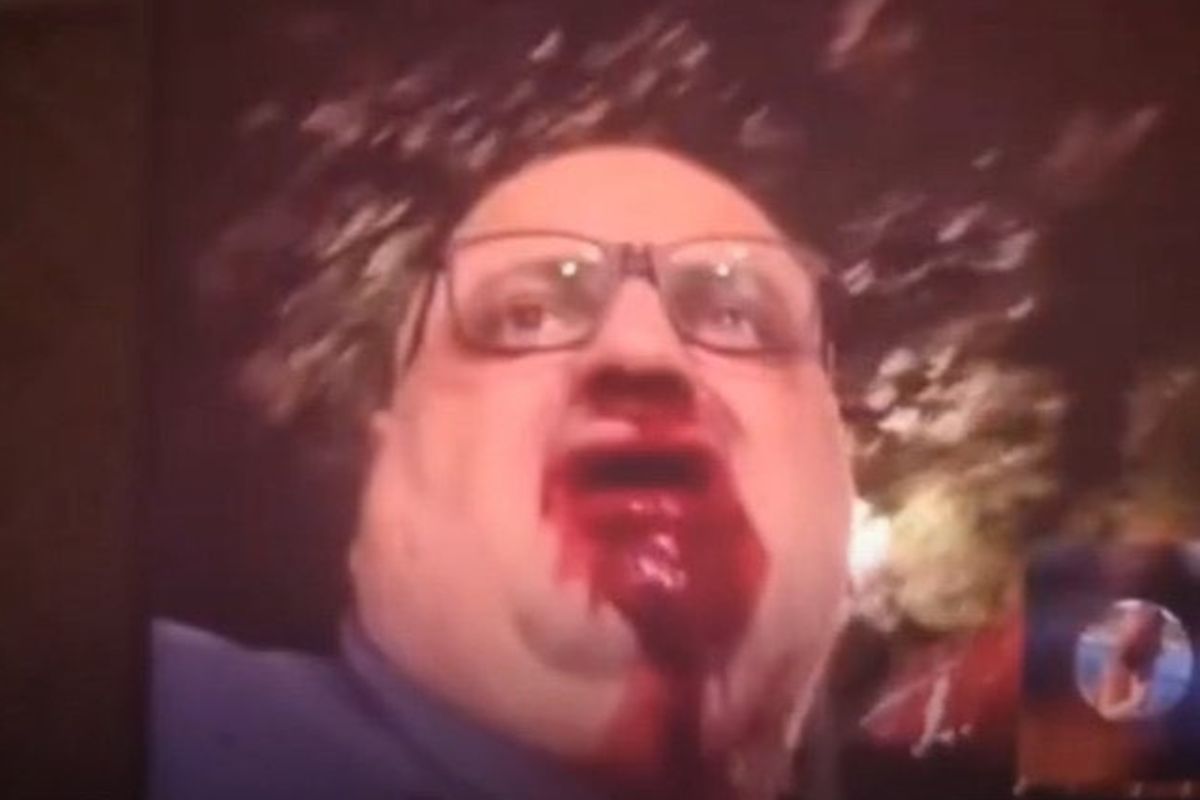 Ashur Sarnaya dopo l'accoltellamento in diretta su TikTok