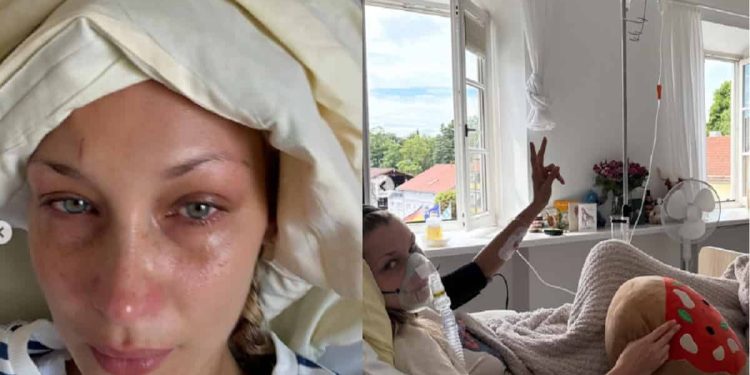 bella hadid in ospedale