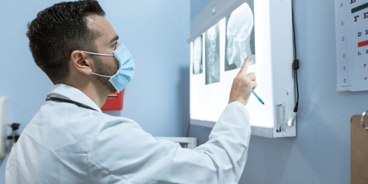 Lastra al cervello e Raggi-X (Foto: Pexels)
