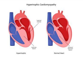 Malattia di Martina Nasoni