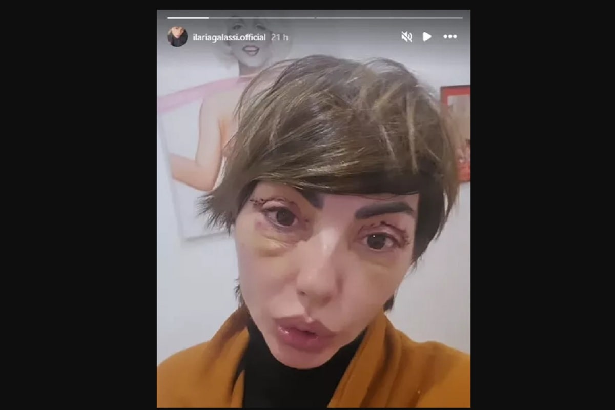 ilaria galassi rifatta